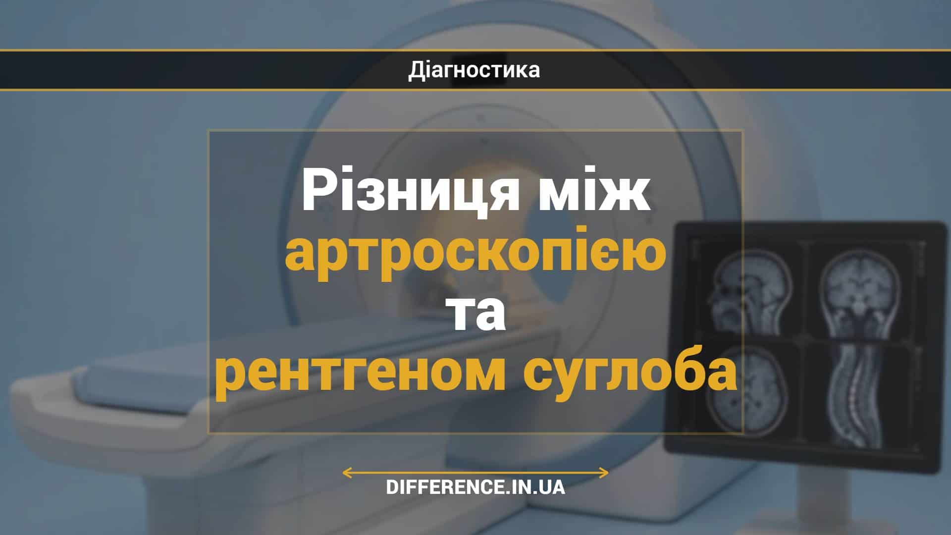 Різниця між артроскопією та рентгеном суглоба