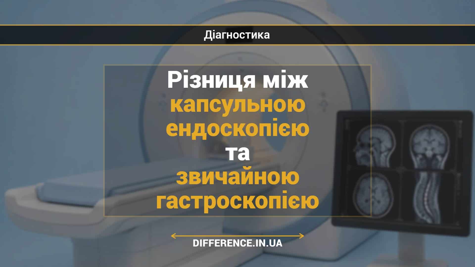 Різниця між капсульною ендоскопією та звичайною гастроскопією