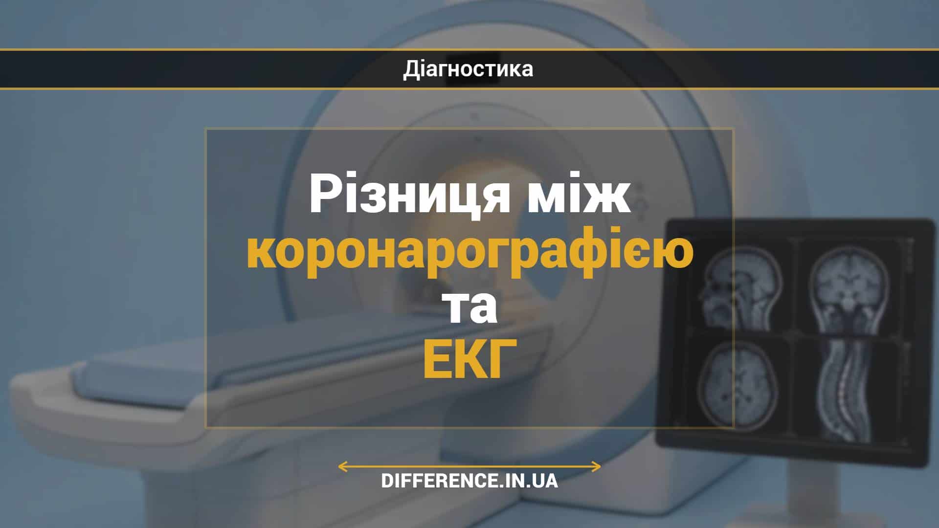 Різниця між коронарографією та ЕКГ
