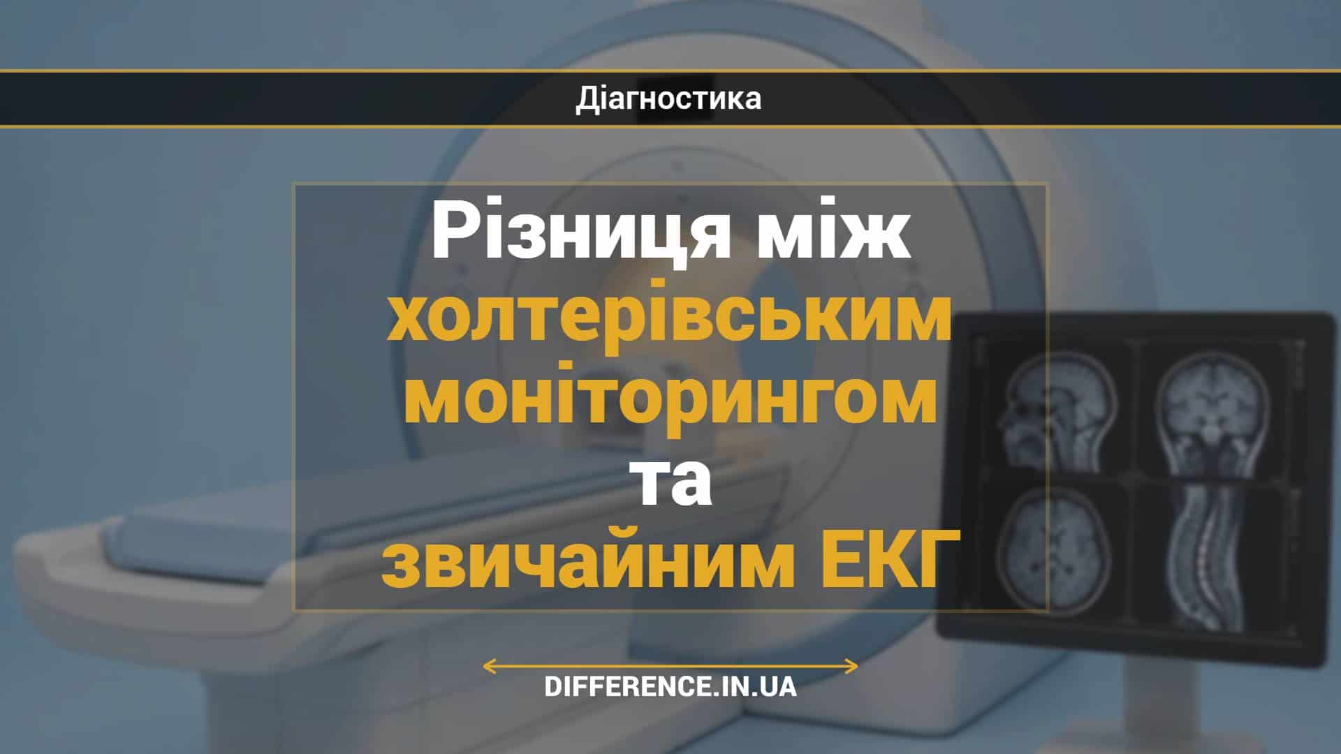 Різниця між холтерівським моніторингом та звичайним ЕКГ