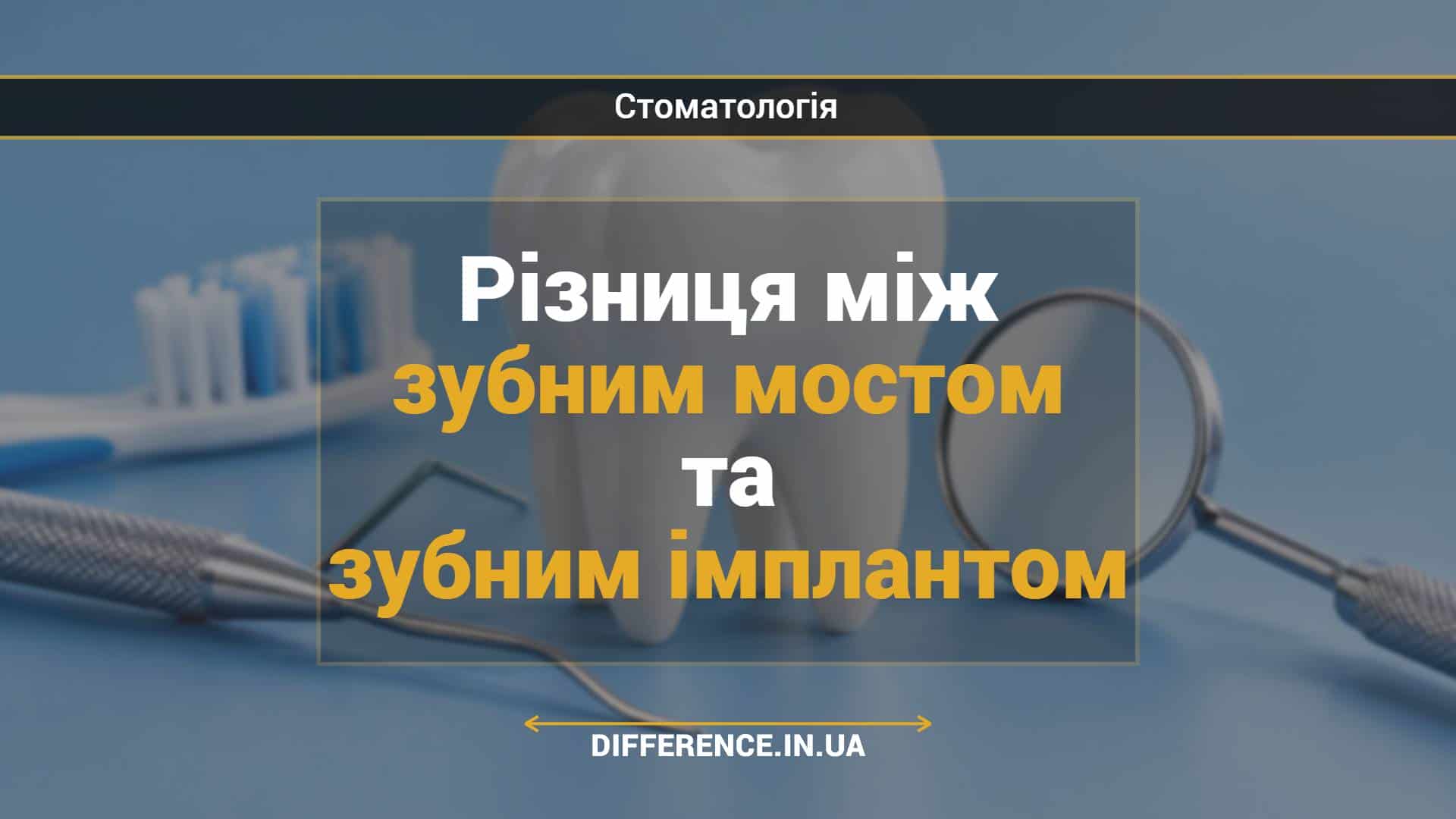 Різниця між зубним мостом та зубним імплантом