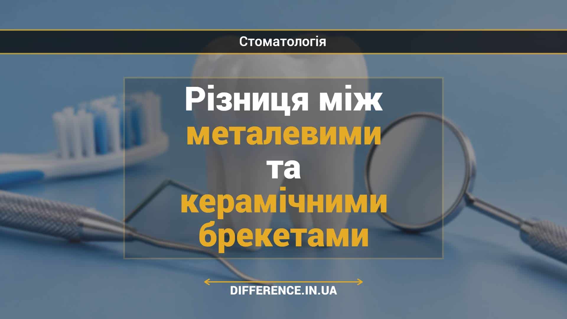Різниця між металевими та керамічними брекетами