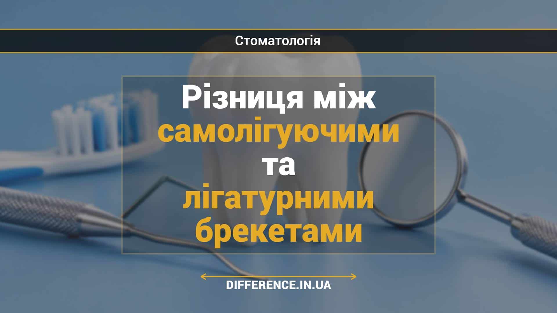 Різниця між самолігуючими та лігатурними брекетами