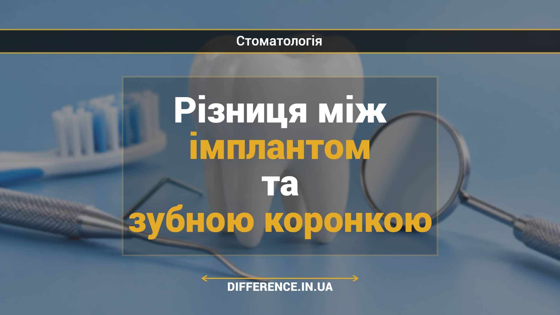 Різниця між імплантом та зубною коронкою